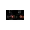 Стайлер Dyson Airwrap I.D. HS08 T3/T4 Curly+Coily Red Velvet/Gold (596928-01) Стайлер Dyson Airwrap I.D. HS08 T3/T4 Curly+Coily Red Velvet/Gold (596928-01)